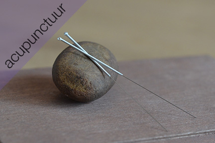 Acupunctuur